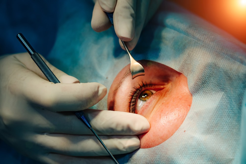 A Complete Guide to LASIK Istanbul Procedures